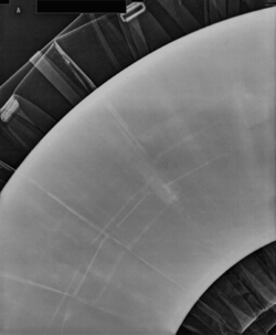 Digital Radiographie / RadiographyAn x-ray image of the application of computed radiography for pipe used in petrochemical industry in order to detect corrosion under insulation when insulation in place. (C) Shutterstock, High Simple