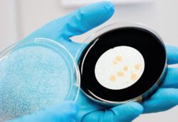 Überprüfung auf Legionellen